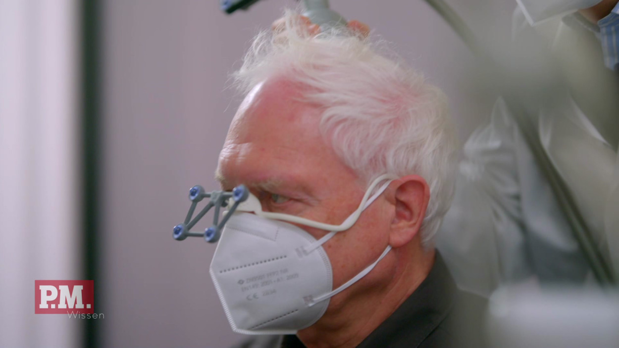 Wie hilft Ultraschall gegen Alzheimer? 