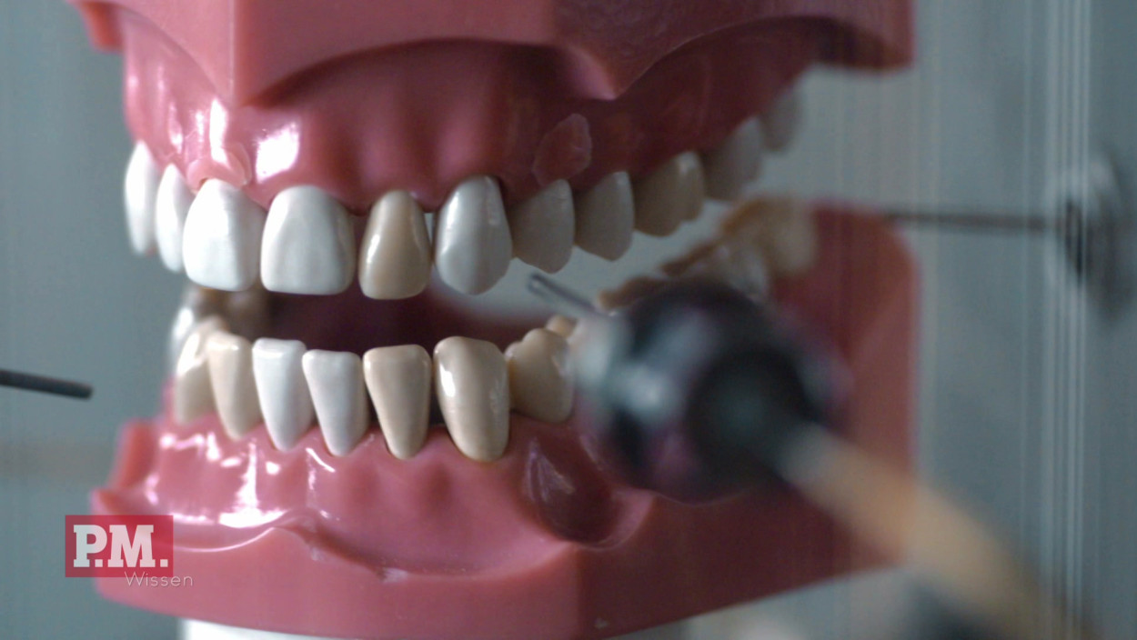 Wie wird Zahnersatz robuster?