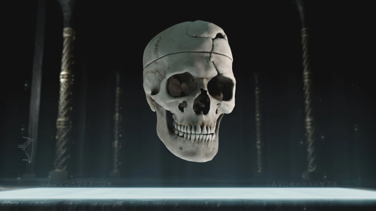 Der Schädel von Phineas Gage